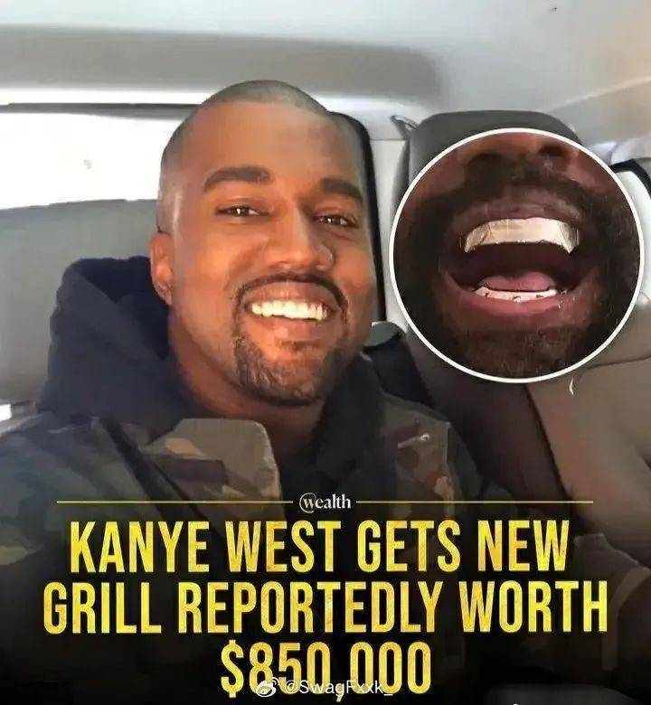离谱！Kanye 登上热搜！610万换的钛合金假牙！